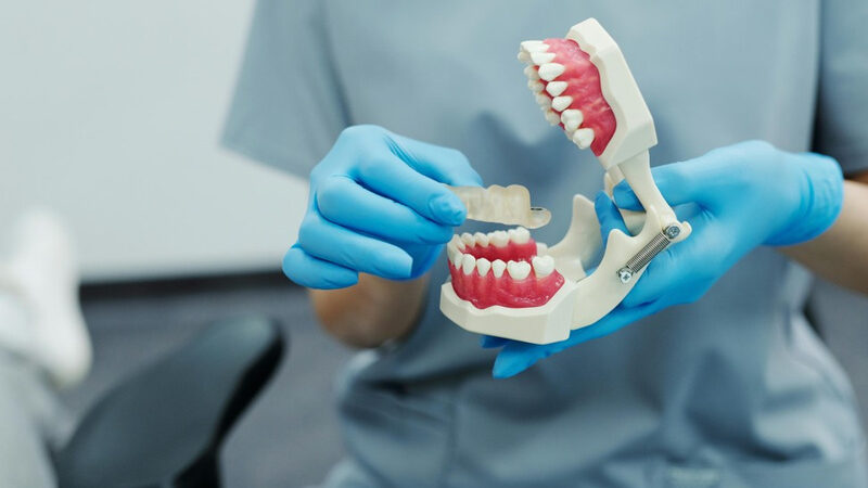 Is a Crown or a Bridge Better for Restoring Your Smile?